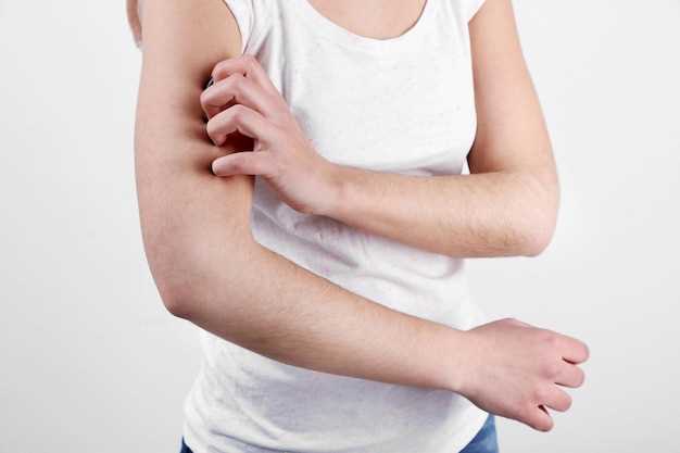 Symptoms of Azithromycin Rash