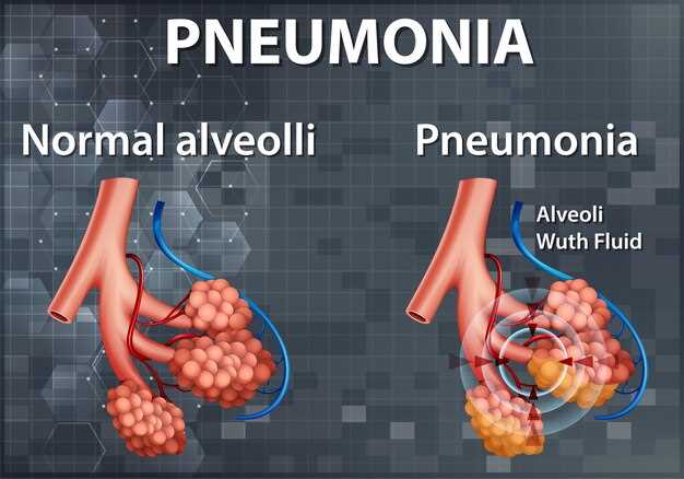 Azithromycin and cystic fibrosis