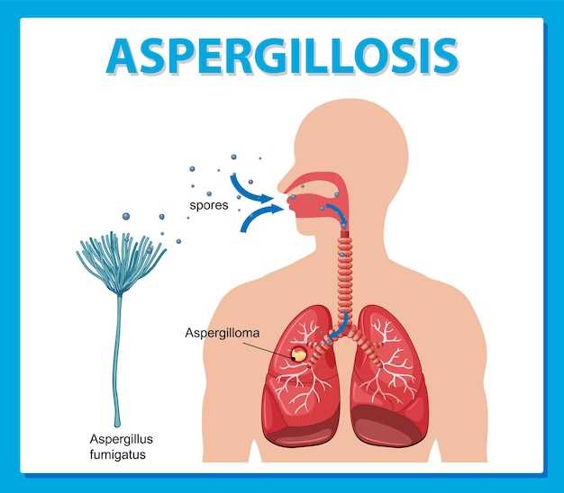 Azithromycin and impetigo