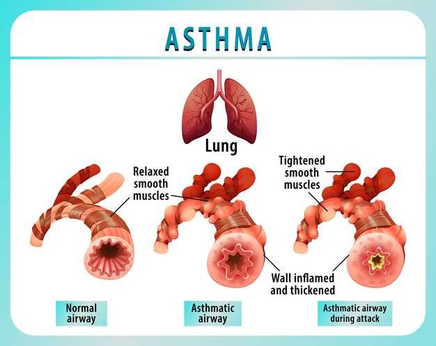 Azithromycin attenuates airway inflammation in a mouse model of viral bronchiolitis