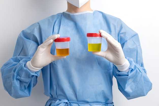 Azithromycin cloudy urine