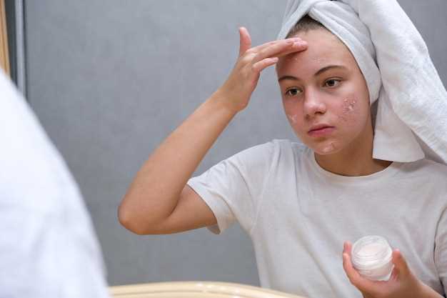 Azithromycin dosage in acne treatment