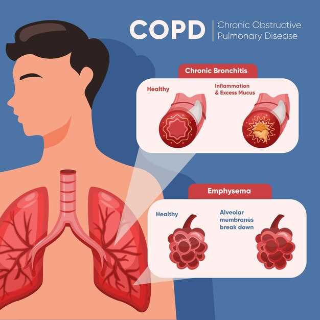 Azithromycin in bronchiolitis obliterans syndrome after hematopoietic sct