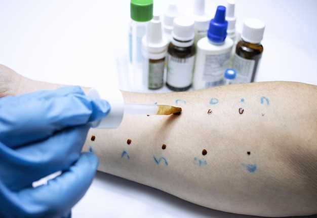 Azithromycin in chicken pox