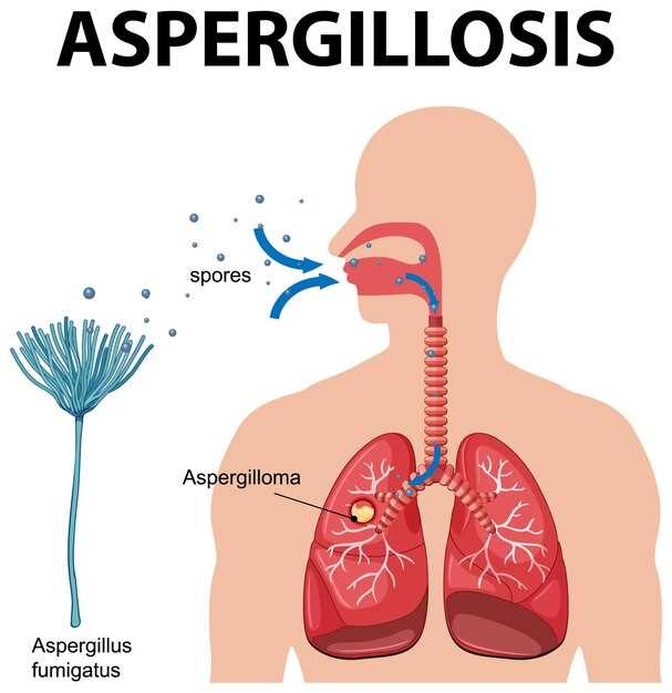 Azithromycin prophylaxis in bronchiectasis