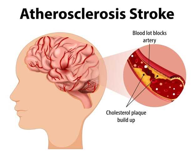 Azithromycin stroke