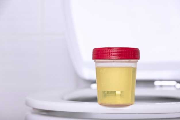 Can azithromycin cause blood urine