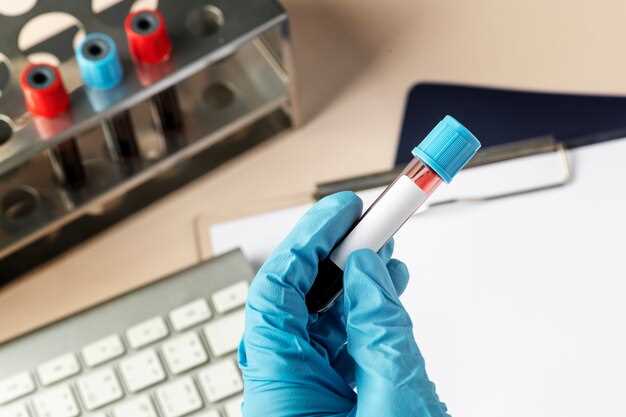 Determination of azithromycin by hplc