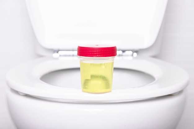 Does azithromycin make you urinate frequently